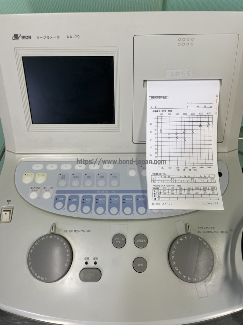 オージオメーター｜リオン株式会社｜AA-79｜中古医療機器の販売・買取