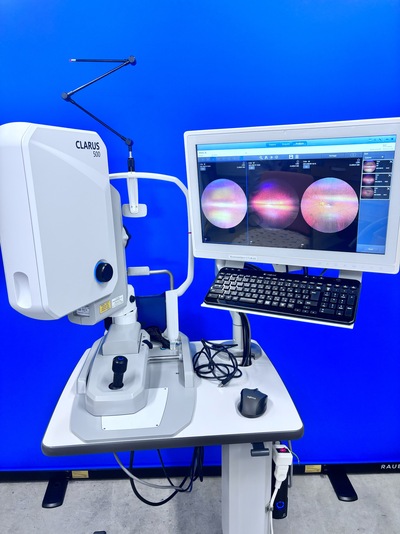 走査型超広角眼底撮影装置 カールツァイスメディテック株式会社 CLARUS 500