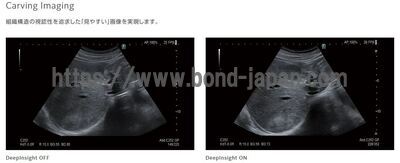 【新品】超音波診断装置 | 富士フイルムヘルスケア | ARIETTA 650 DeepInsightの写真