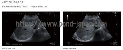 【新品】超音波診断装置 | 富士フイルムメディカル | ARIETTA 650 DeepInsightの写真