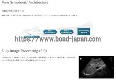 【新品】超音波診断装置 | 富士フイルムヘルスケア | ARIETTA 50の写真