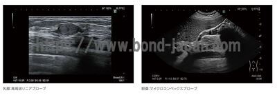 【新品】超音波診断装置 | 富士フイルムメディカル | ARIETTA 650 DeepInsightの写真