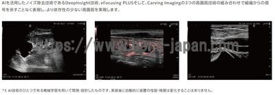 【新品】超音波診断装置 | 富士フイルムメディカル | ARIETTA 850 DeepInsightの写真