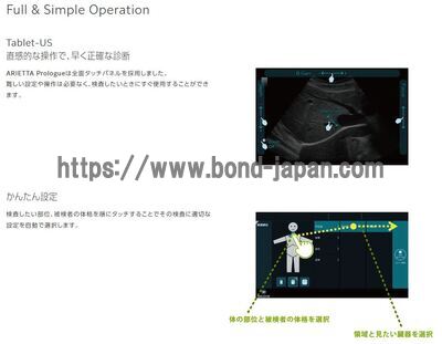 【新品】超音波診断装置 | 富士フイルムヘルスケア | ARIETTA Prologueの写真