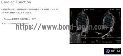 【新品】超音波診断装置 | 富士フイルムメディカル | ARIETTA 650 DeepInsightの写真