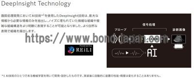 【新品】超音波診断装置 | 富士フイルムヘルスケア | ARIETTA 850 DeepInsightの写真