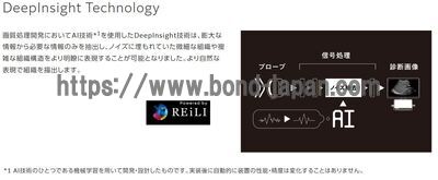 【新品】超音波診断装置 | 富士フイルムメディカル | ARIETTA 850 DeepInsightの写真
