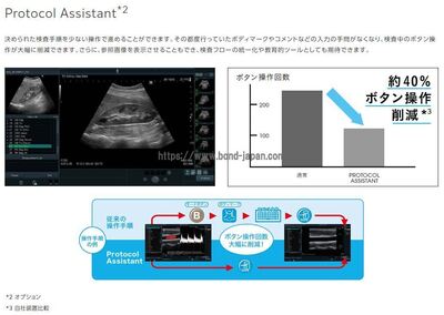 【新品】超音波診断装置&nbsp;|&nbsp;富士フイルムメディカル&nbsp;|&nbsp;ARIETTA 65LEの写真