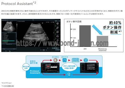 【新品】超音波診断装置 | 富士フイルムメディカル | ARIETTA 65LEの写真