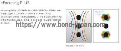 【新品】超音波診断装置 | 富士フイルムメディカル | ARIETTA 850 DeepInsightの写真