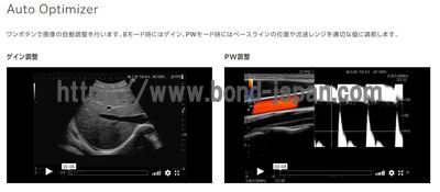 【新品】超音波診断装置 | 富士フイルムメディカル | ARIETTA 65LEの写真