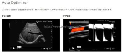 【新品】超音波診断装置&nbsp;|&nbsp;富士フイルムメディカル&nbsp;|&nbsp;ARIETTA 65LEの写真