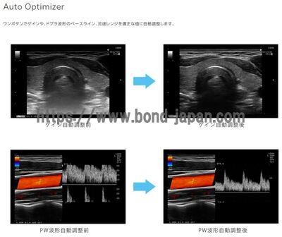 【新品】超音波診断装置 | 富士フイルムヘルスケア | ARIETTA 50の写真