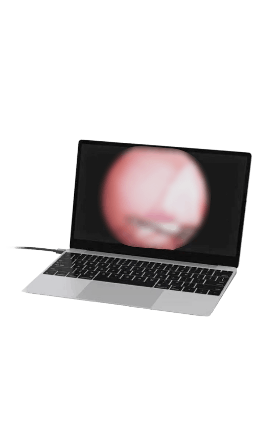 PCによる内視鏡検査の様子
